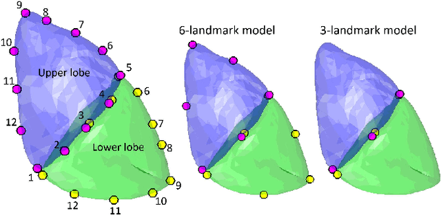 Figure 3 for Kernel-based framework to estimate deformations of pneumothorax lung using relative position of anatomical landmarks