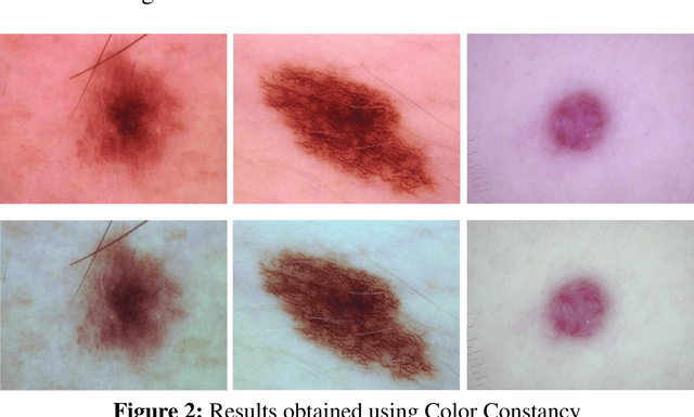 Figure 2 for Skin lesion segmentation and classification using deep learning and handcrafted features