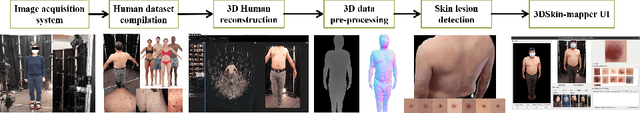 Figure 3 for Monitoring of Pigmented Skin Lesions Using 3D Whole Body Imaging