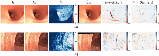 Figure 3 for Motion-based Camera Localization System in Colonoscopy Videos