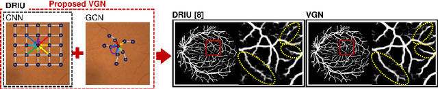 Figure 1 for Deep Vessel Segmentation By Learning Graphical Connectivity