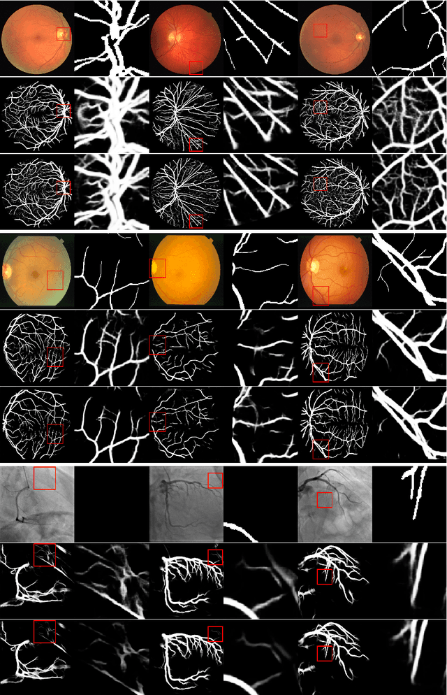 Figure 4 for Deep Vessel Segmentation By Learning Graphical Connectivity