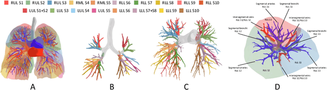 Figure 1 for What Makes for Automatic Reconstruction of Pulmonary Segments