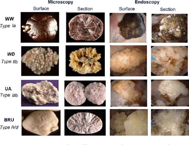 Figure 4 for On the in vivo recognition of kidney stones using machine learning
