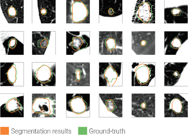Figure 2 for Lung Nodules Detection and Segmentation Using 3D Mask-RCNN