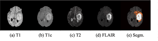 Figure 1 for Transfer Learning for Brain Tumor Segmentation