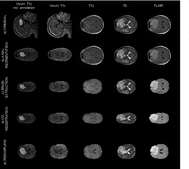 Figure 3 for Transfer Learning for Brain Tumor Segmentation