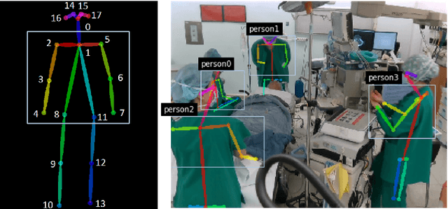 Figure 3 for Fully Automated Hand Hygiene Monitoring\\in Operating Room using 3D Convolutional Neural Network