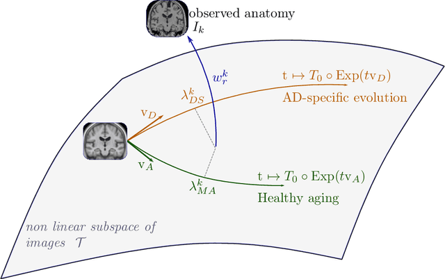 Figure 3 for A model of brain morphological changes related to aging and Alzheimer's disease from cross-sectional assessments