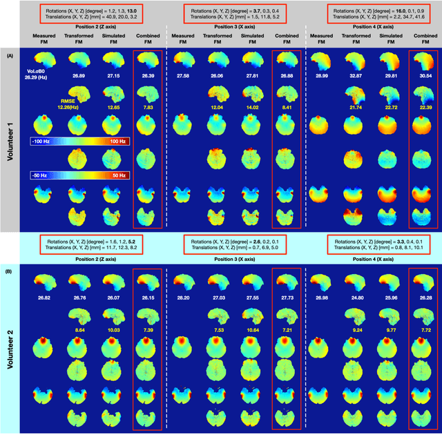 Figure 3 for Prediction of motion induced magnetic fields for human brain MRI at 3T