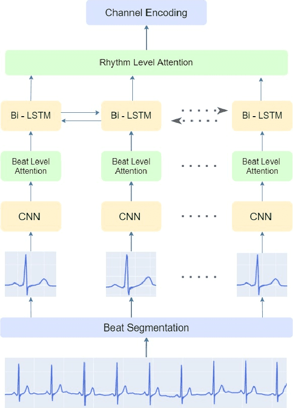 Figure 1 for IMLE-Net: An Interpretable Multi-level Multi-channel Model for ECG Classification