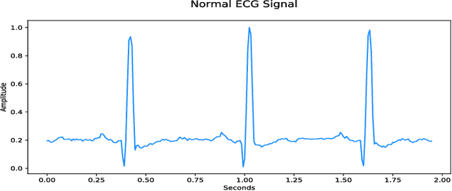Figure 1 for Synthesis of Realistic ECG using Generative Adversarial Networks