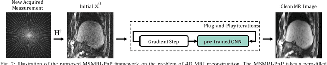 Figure 2 for Image Reconstruction for MRI using Deep CNN Priors Trained without Groundtruth