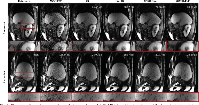Figure 3 for Image Reconstruction for MRI using Deep CNN Priors Trained without Groundtruth
