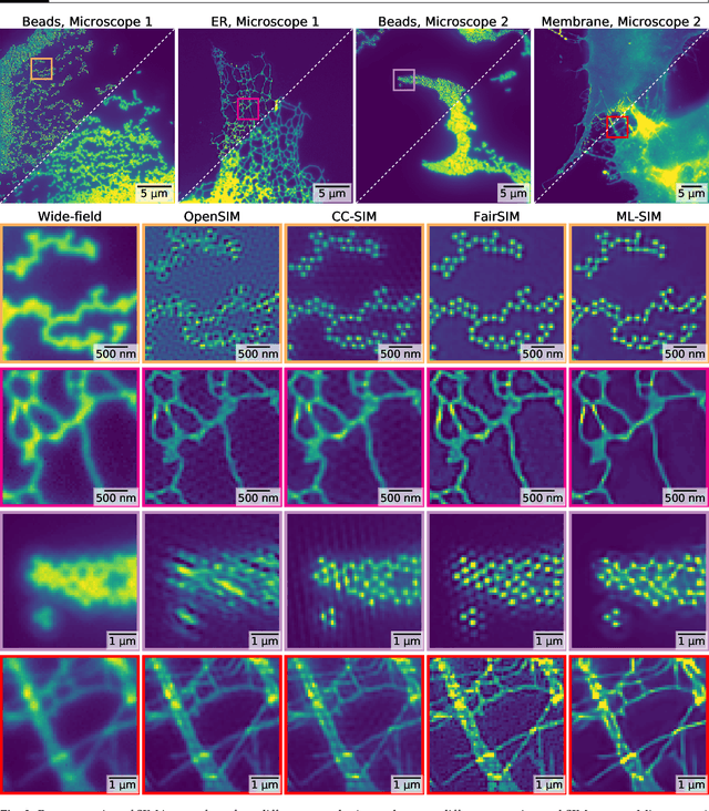 Figure 4 for ML-SIM: A deep neural network for reconstruction of structured illumination microscopy images