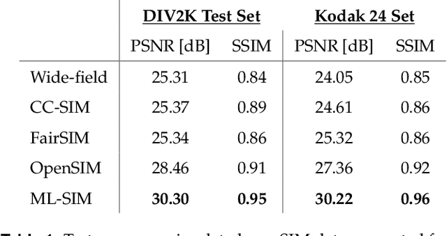 Figure 2 for ML-SIM: A deep neural network for reconstruction of structured illumination microscopy images