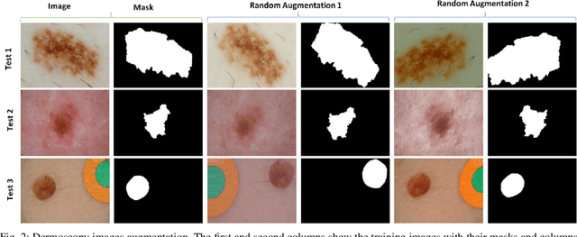 Figure 2 for SkinNet: A Deep Learning Framework for Skin Lesion Segmentation