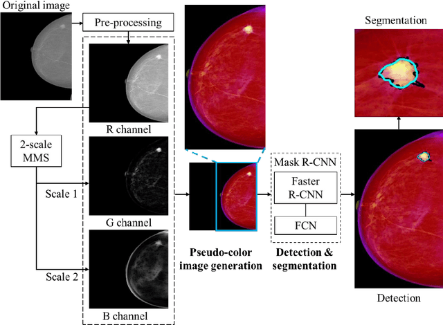 Figure 1 for Fully automatic computer-aided mass detection and segmentation via pseudo-color mammograms and Mask R-CNN