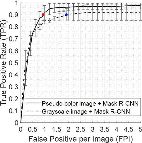 Figure 3 for Fully automatic computer-aided mass detection and segmentation via pseudo-color mammograms and Mask R-CNN