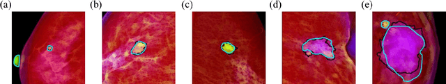 Figure 4 for Fully automatic computer-aided mass detection and segmentation via pseudo-color mammograms and Mask R-CNN