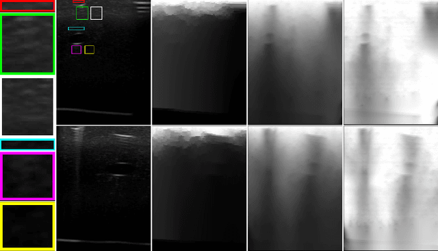 Figure 3 for Ultrasound Confidence Maps of Intensity and Structure Based on Directed Acyclic Graphs and Artifact Models