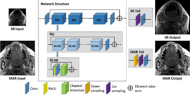Figure 1 for Edge, Structure and Texture Refinement for Retrospective High Quality MRI Restoration using Deep Learning