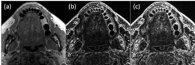 Figure 4 for Edge, Structure and Texture Refinement for Retrospective High Quality MRI Restoration using Deep Learning