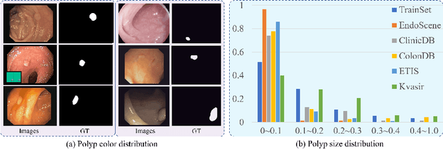 Figure 1 for Shallow Attention Network for Polyp Segmentation