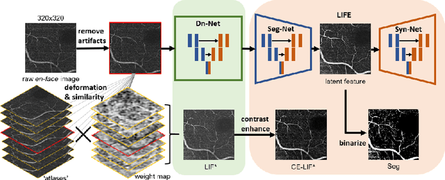 Figure 1 for LIFE: A Generalizable Autodidactic Pipeline for 3D OCT-A Vessel Segmentation