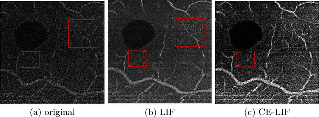 Figure 3 for LIFE: A Generalizable Autodidactic Pipeline for 3D OCT-A Vessel Segmentation