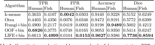 Figure 2 for LIFE: A Generalizable Autodidactic Pipeline for 3D OCT-A Vessel Segmentation