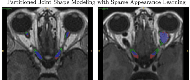 Figure 3 for Partitioned Shape Modeling with On-the-Fly Sparse Appearance Learning for Anterior Visual Pathway Segmentation