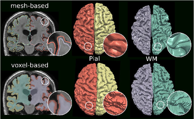 Figure 1 for Vox2Cortex: Fast Explicit Reconstruction of Cortical Surfaces from 3D MRI Scans with Geometric Deep Neural Networks