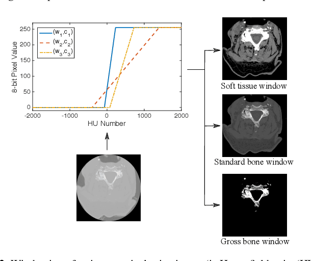 Figure 3 for Deep Sequential Learning for Cervical Spine Fracture Detection on Computed Tomography Imaging