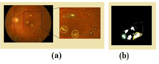 Figure 3 for SSEGEP: Small SEGment Emphasized Performance evaluation metric for medical image segmentation