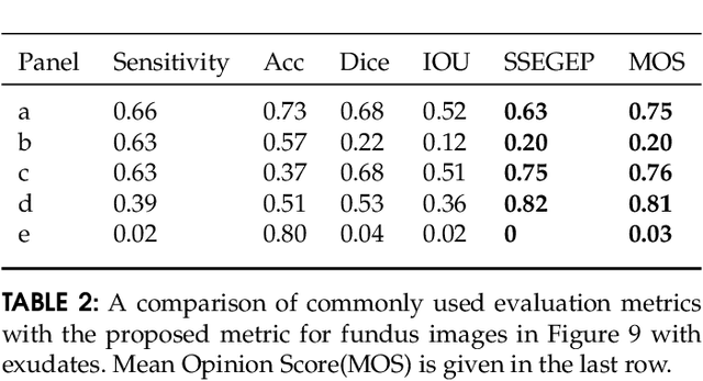 Figure 4 for SSEGEP: Small SEGment Emphasized Performance evaluation metric for medical image segmentation