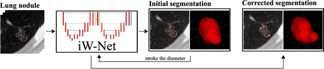 Figure 1 for iW-Net: an automatic and minimalistic interactive lung nodule segmentation deep network