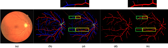 Figure 1 for Learning to Address Intra-segment Misclassification in Retinal Imaging