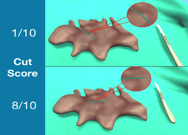 Figure 1 for Assessing unconstrained surgical cuttings in VR using CNNs