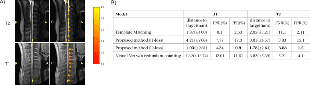 Figure 2 for Spine intervertebral disc labeling using a fully convolutional redundant counting model