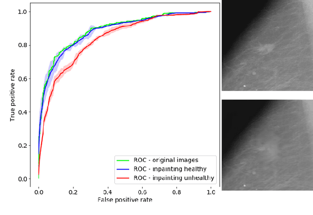 Figure 3 for Interpreting Medical Image Classifiers by Optimization Based Counterfactual Impact Analysis