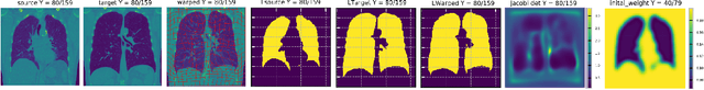 Figure 3 for Region-specific Diffeomorphic Metric Mapping