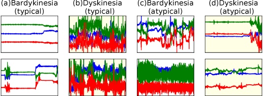 Figure 1 for Data Augmentation of Wearable Sensor Data for Parkinson's Disease Monitoring using Convolutional Neural Networks