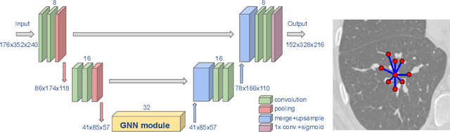 Figure 1 for A joint 3D UNet-Graph Neural Network-based method for Airway Segmentation from chest CTs