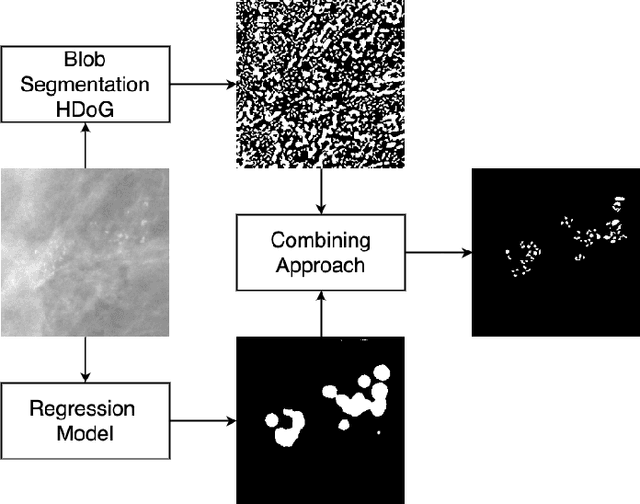Figure 1 for Segmentation of Breast Microcalcifications: A Multi-Scale Approach