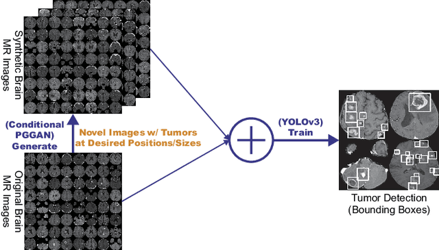 Figure 1 for Learning More with Less: Conditional PGGAN-based Data Augmentation for Brain Metastases Detection Using Highly-Rough Annotation on MR Images