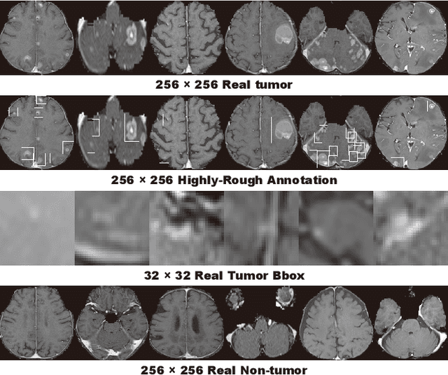 Figure 3 for Learning More with Less: Conditional PGGAN-based Data Augmentation for Brain Metastases Detection Using Highly-Rough Annotation on MR Images