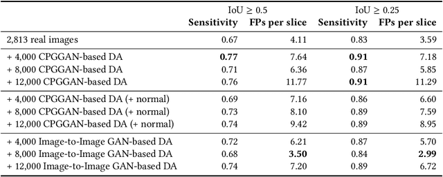 Figure 2 for Learning More with Less: Conditional PGGAN-based Data Augmentation for Brain Metastases Detection Using Highly-Rough Annotation on MR Images