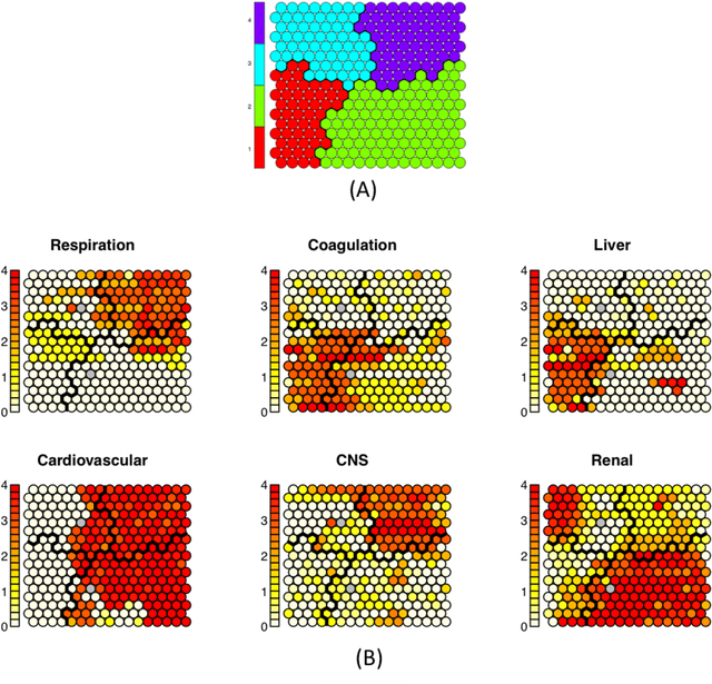 Figure 3 for On Classifying Sepsis Heterogeneity in the ICU: Insight Using Machine Learning