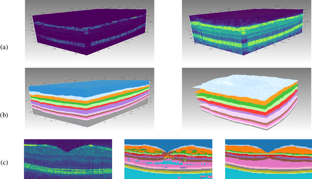 Figure 3 for Assignment Flow for Order-Constrained OCT Segmentation